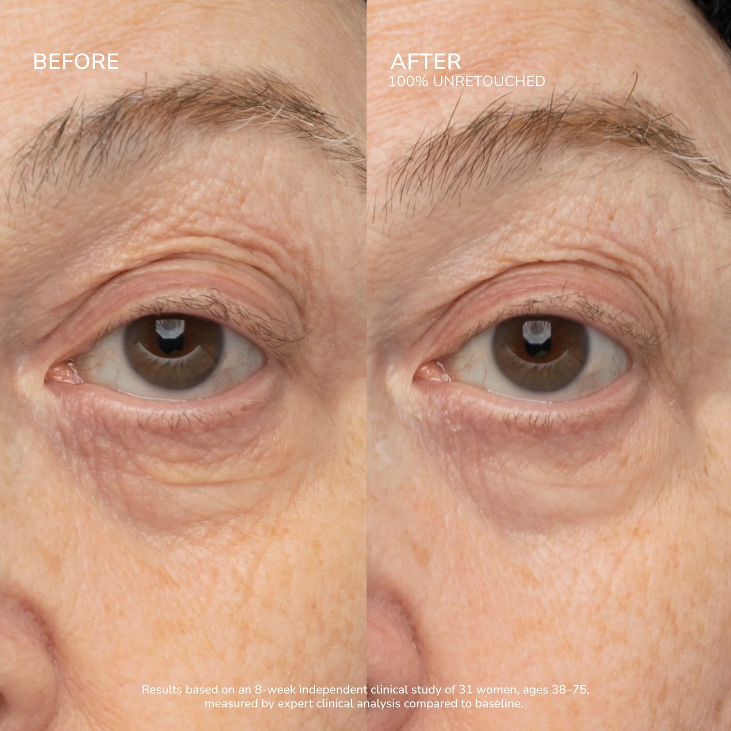 SeneCell™ SenePlex+® StemCell Concentrate
