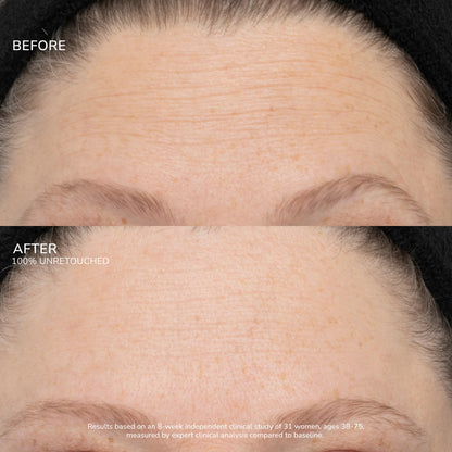 SeneCell™ SenePlex+® StemCell Concentrate